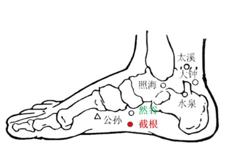 截根穴位置|实战中医讲堂：截根疗法简介及几种疾病的操作方法